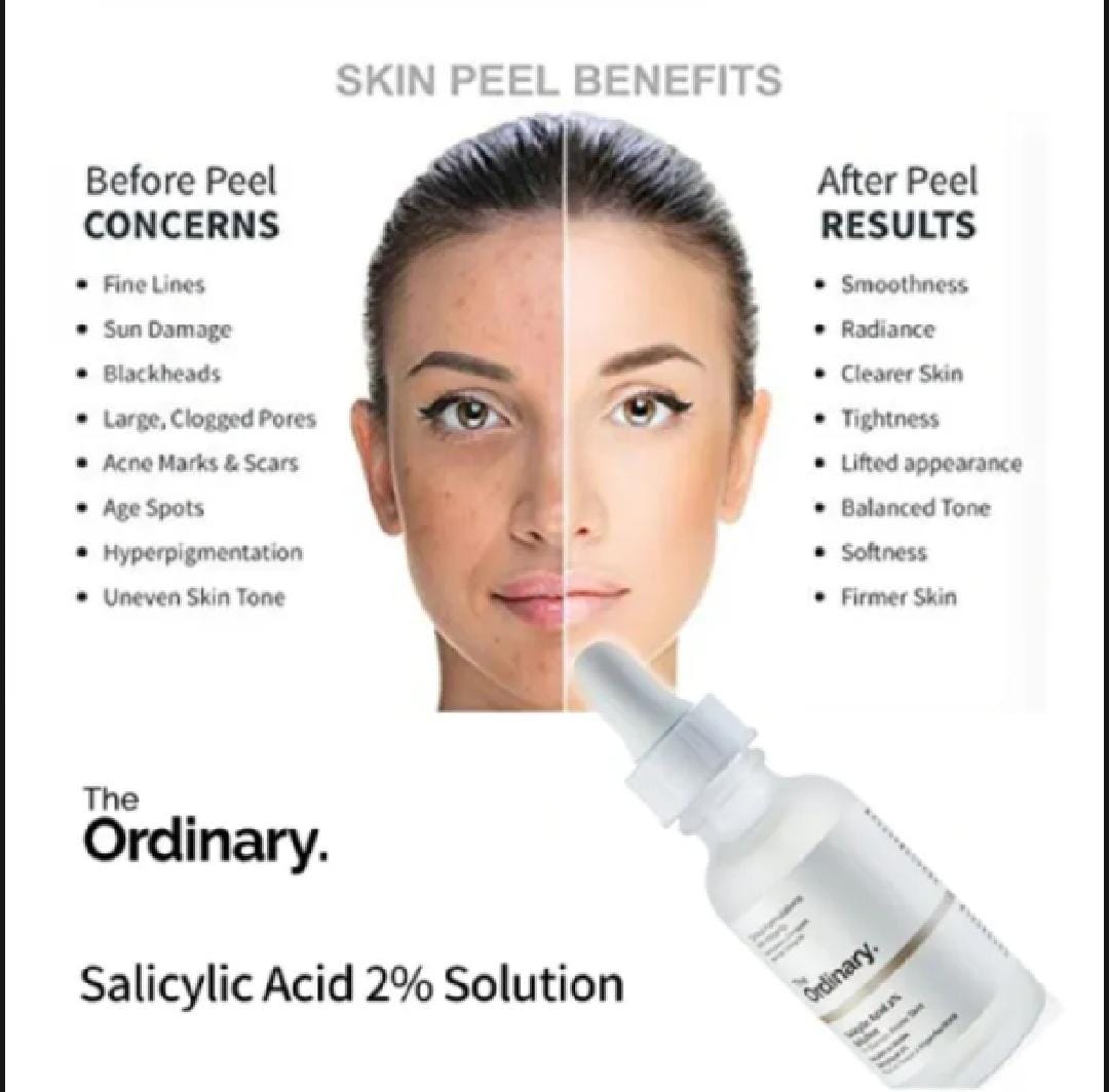The Ordinary Niacinamide 10% + Zinc 1% High-Strength Vitamin and Mineral Blemish Formula